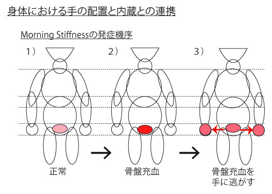 MorningStffnessの機序