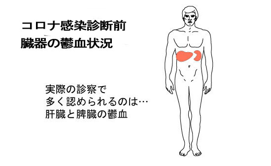 コロナ感染の臓器鬱血